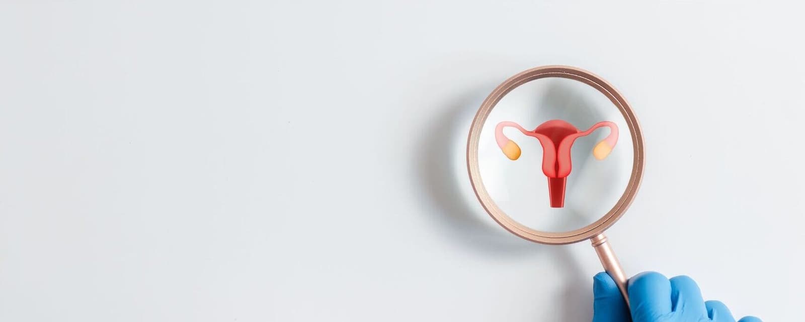 Miomas, pólipos y adenomiosis: cuándo sí afectan la implantación y cuándo no