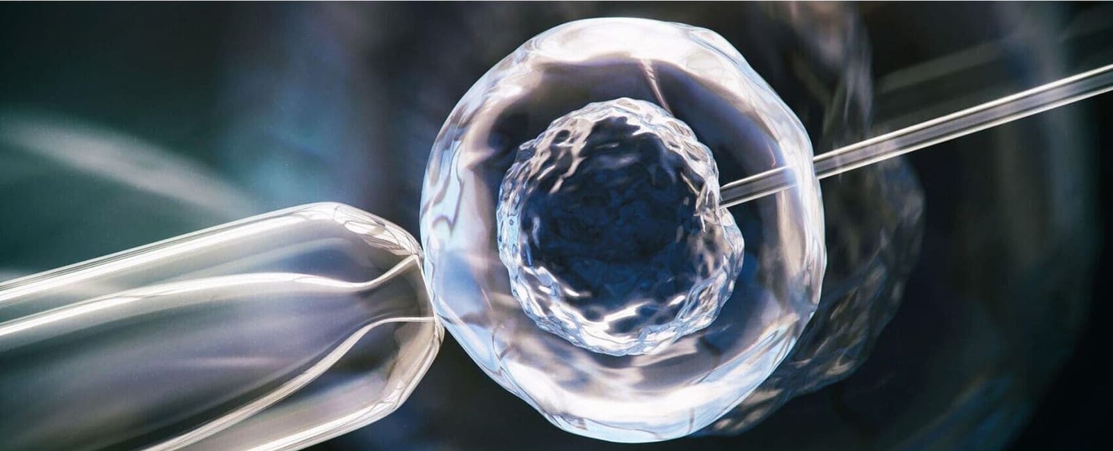 In Vitro Fertilization in Complex Cases: How a Multi-Level Approach Helped Achieve a Pregnancy