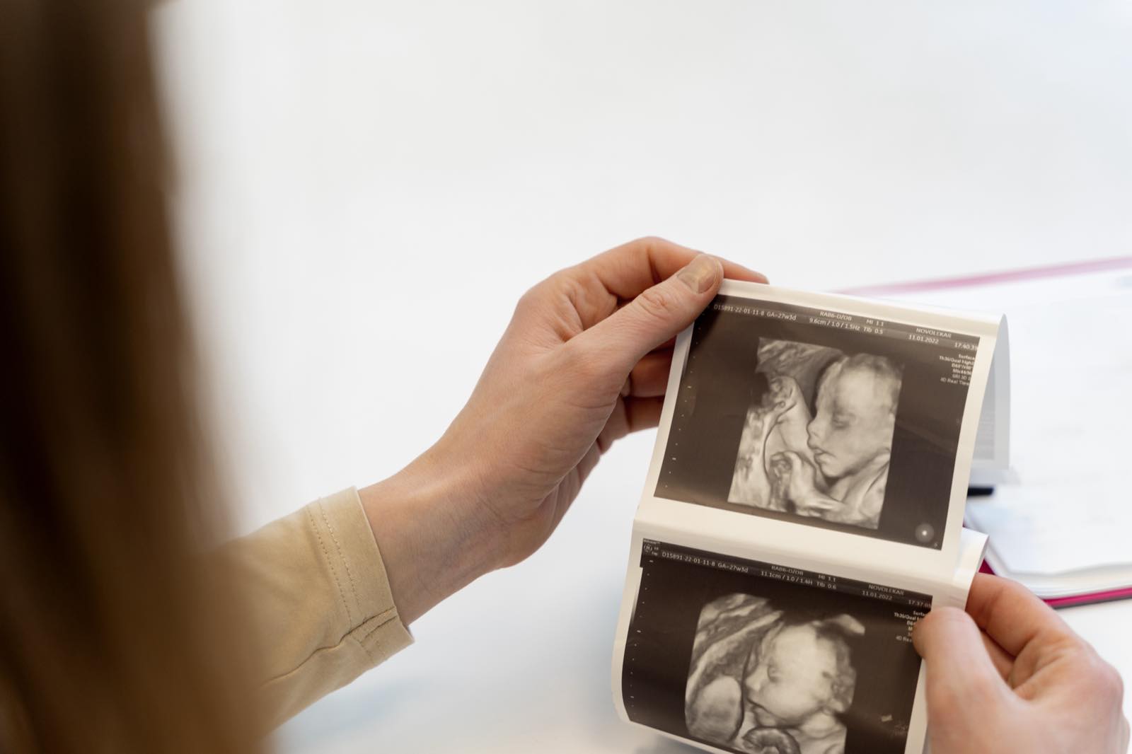 Mujer sosteniendo las imágenes impresas de un ultrasonido de embarazo