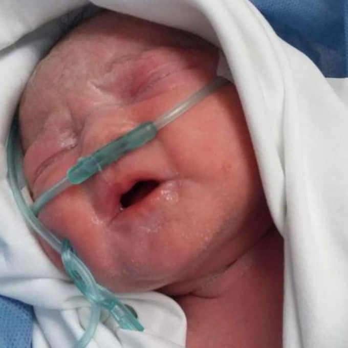bebe-recien-nacida-via-fecundacion-in-vitro