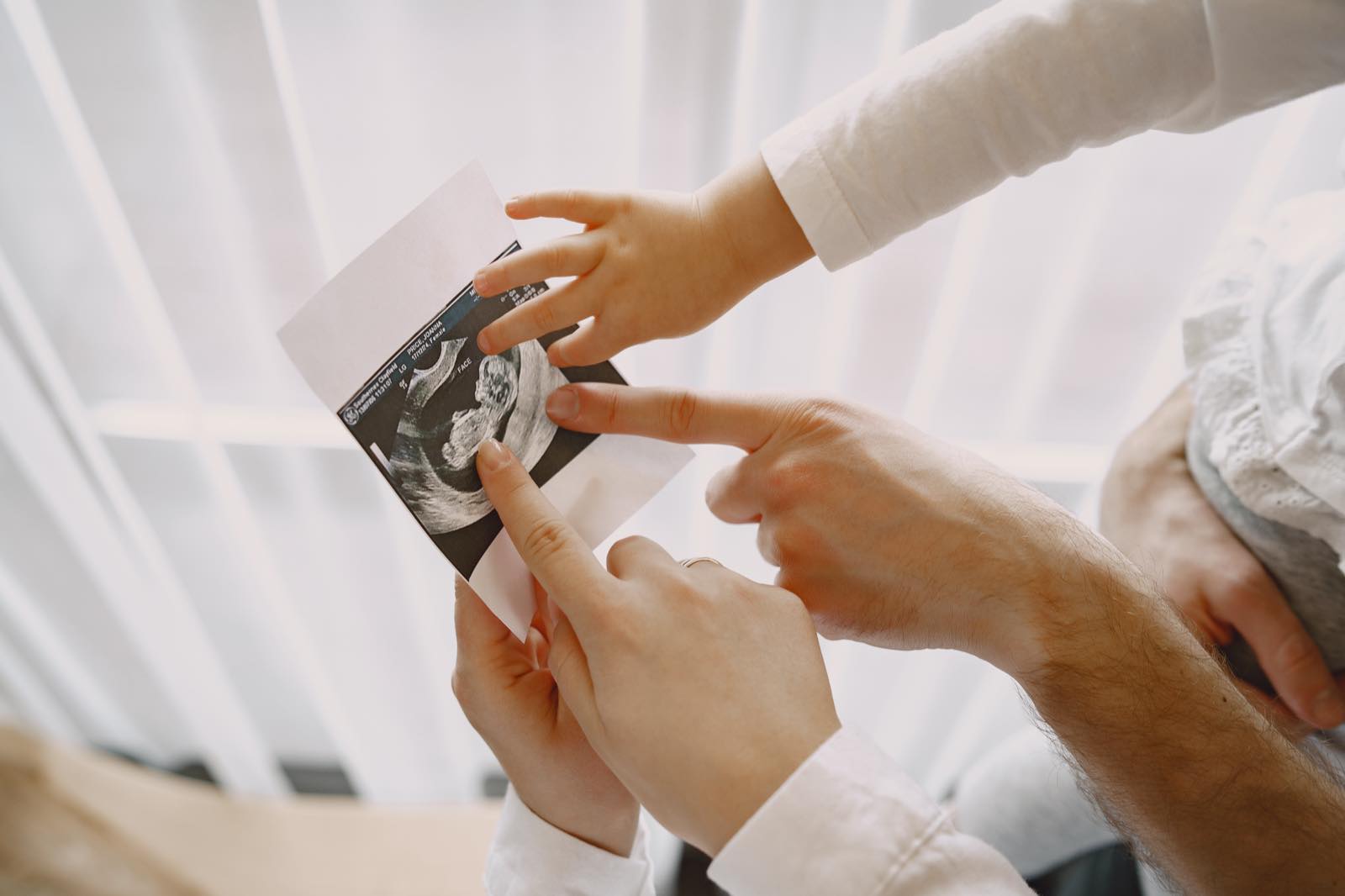 Una pareja señala con el dedo la imagen de un ultrasonido obstétrico impreso